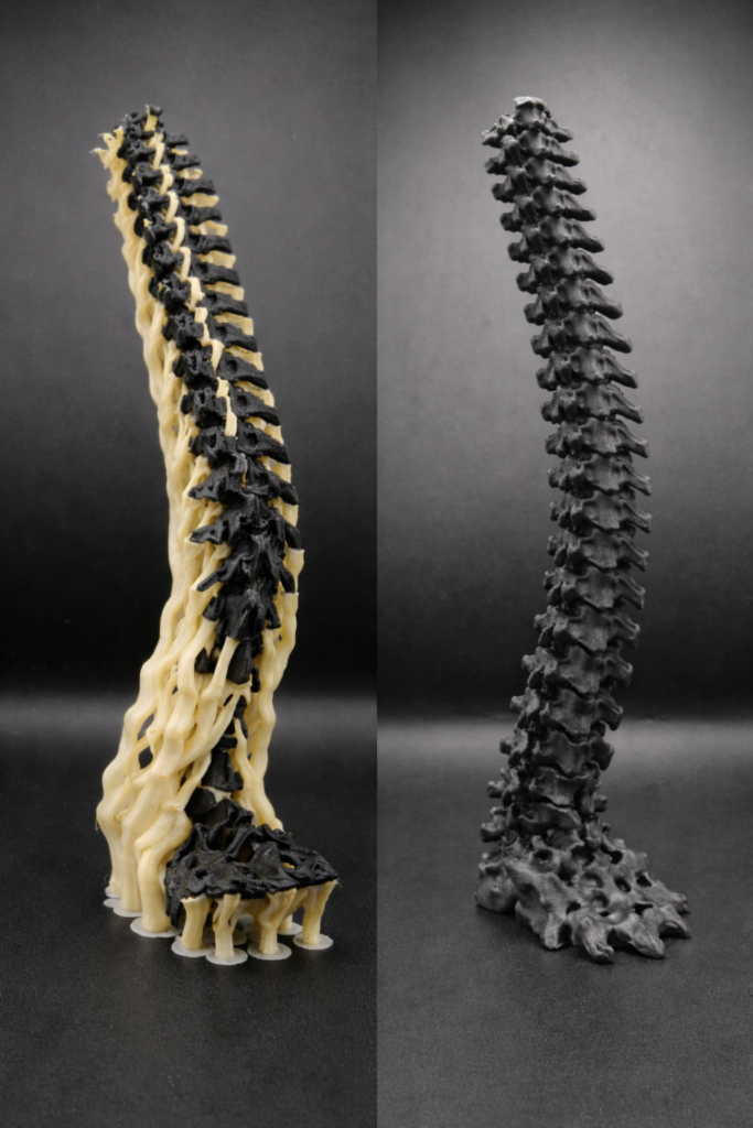 Difference imprimé en support